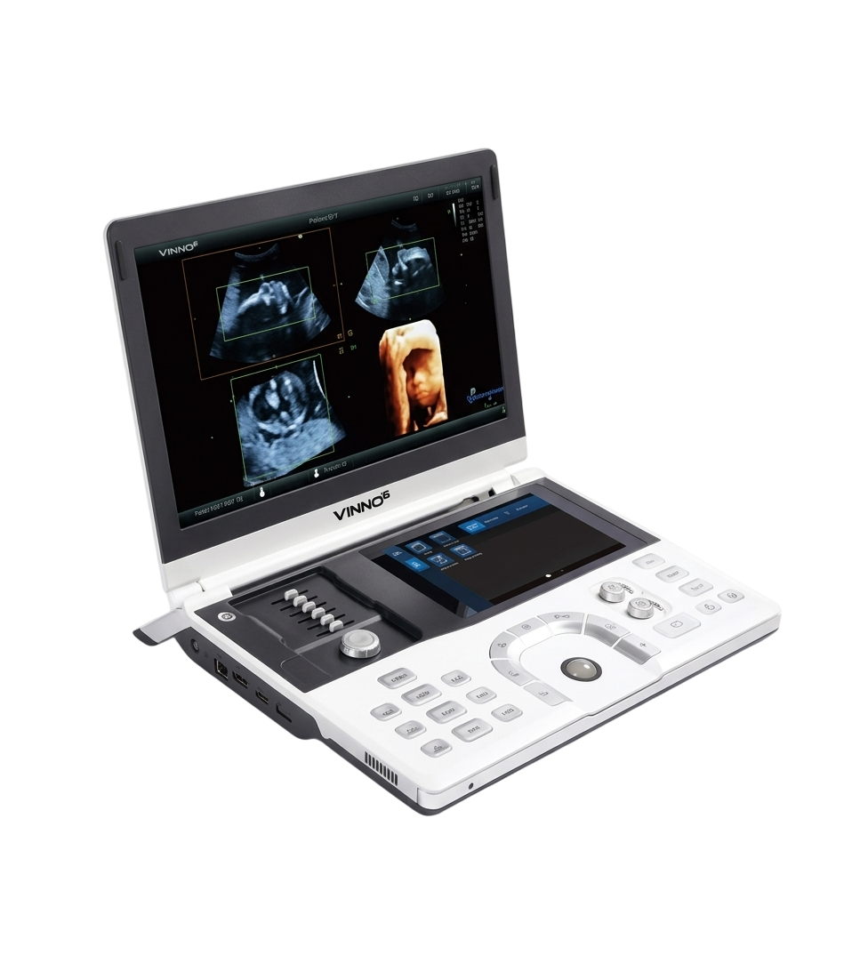 Ультразвуковой сканер «VINNO 6» высокого класса